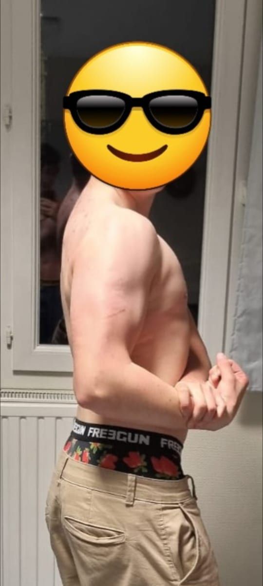 Profil von Erasme